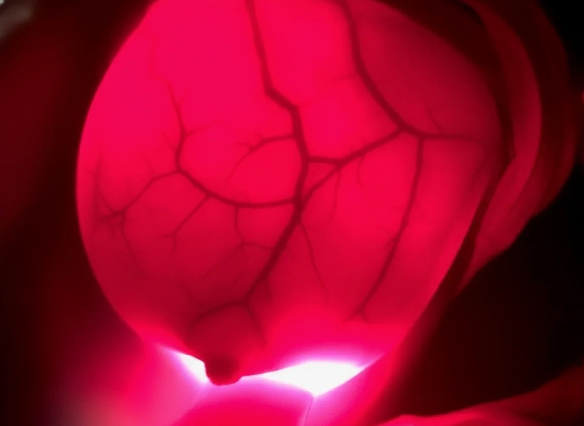 Healthy, inconspicuous breast (Reference)